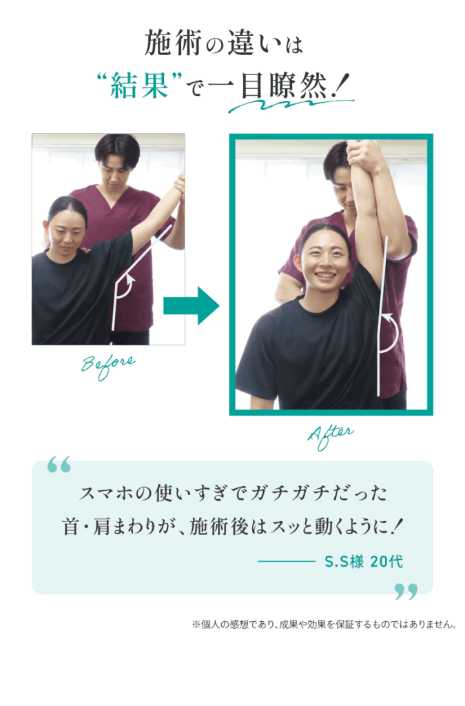 施術の違いは“結果”で一目瞭然！スマホの使いすぎでガチガチだった首・肩まわりが、施術後はスッと動くように！S.S様 20代