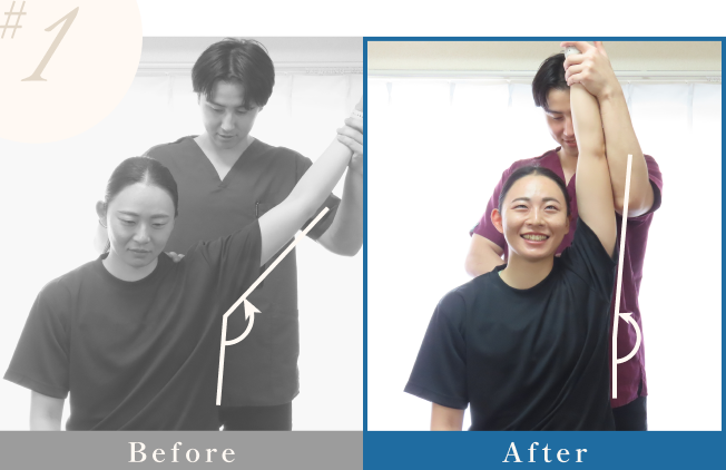 肩の可動域のビフォーアフター