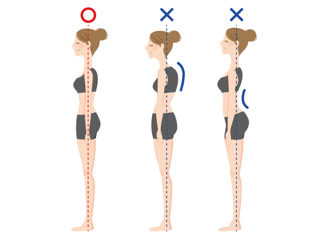 横向きの姿勢比較のイラスト 反り腰や猫背と良い姿勢の例